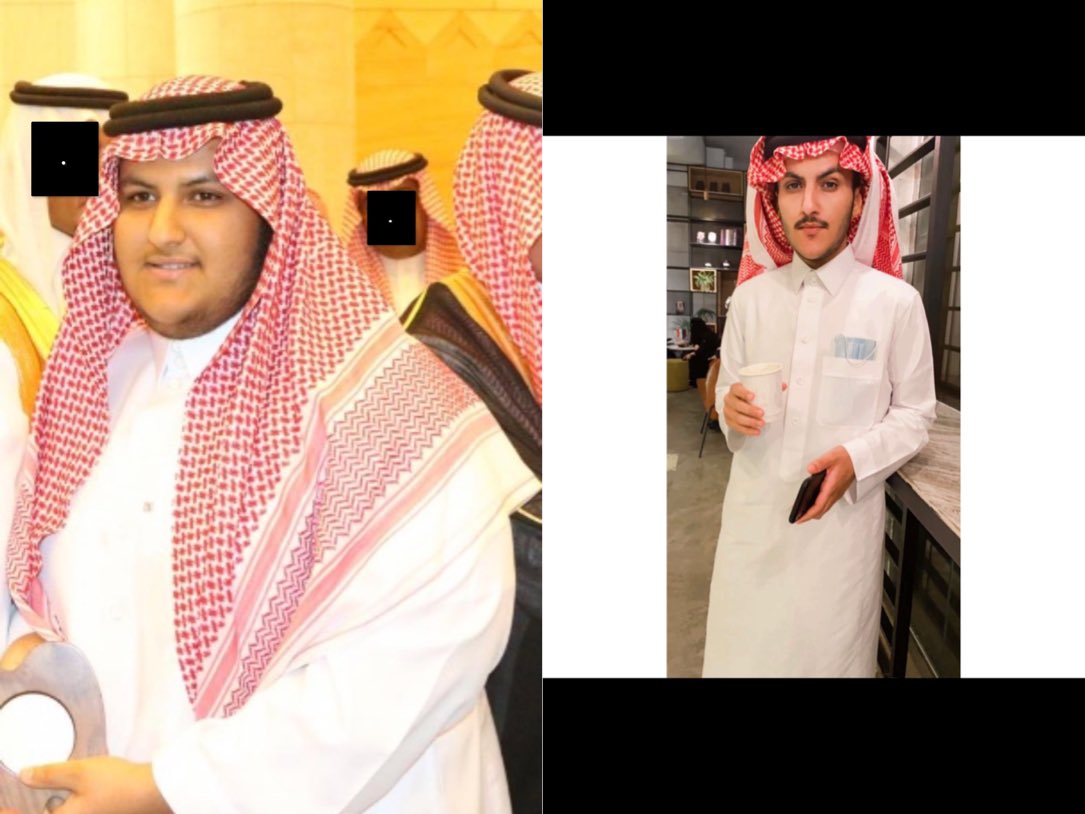 en1_xi's tweet photo. الحمد لله بعد فضل الله اليوم اقدر اقول كملت السنه الاولى من بعد التكميم وللامانه اعتبرها افضل سنه مرت علي في حياتي 

للتحفيز 

الوزن قبل: 150
الوزن بعد:64
المده: سنة

#كم_وزنك_قبل_وبعد_التكميم_وكم_المده 

#رابطة_المتكممين 
#رابطه_المكممين 
@tkmem https://t.co/ZYtsxbPGqd