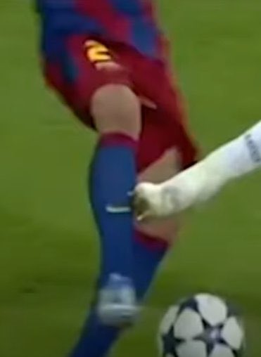 With that being said, I will break down each of the incidents RamosBenz presented one by one.1st incident: That was a clear foul by Suarez (legitimate - wrong decision from the ref)2nd incident: Pepe clearly makes contact with Alves' shin (Pepe rightfully sent off)