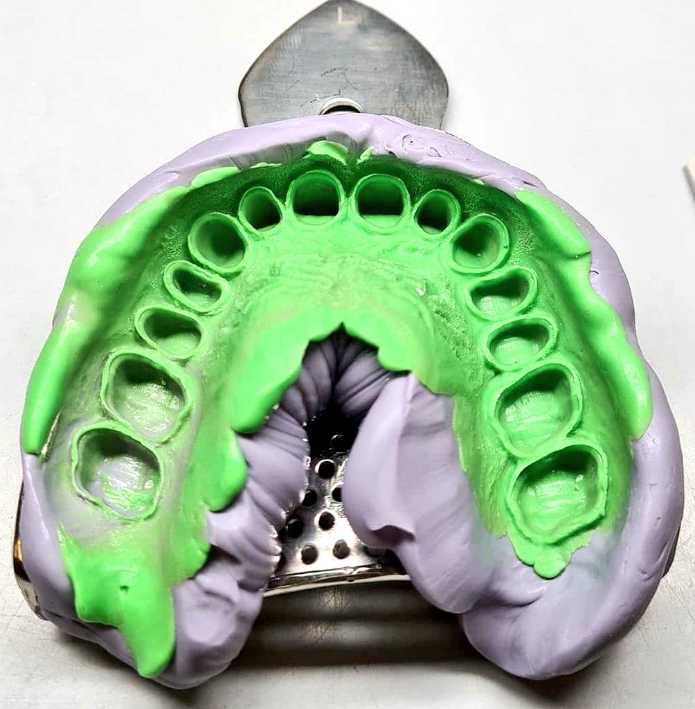 DentalPerfectDP's tweet photo. ¿Qué cuánto cuesta una corona o un puente fijo? No sólo interviene la calidad de los materiales, también la experiencia y conocimiento del odontólogo. No busque precio, busque calidad. 
#DéjanosFascinarte
#puentefijo
#coronadeporcelana
#diente https://t.co/oc5W6vGKSZ