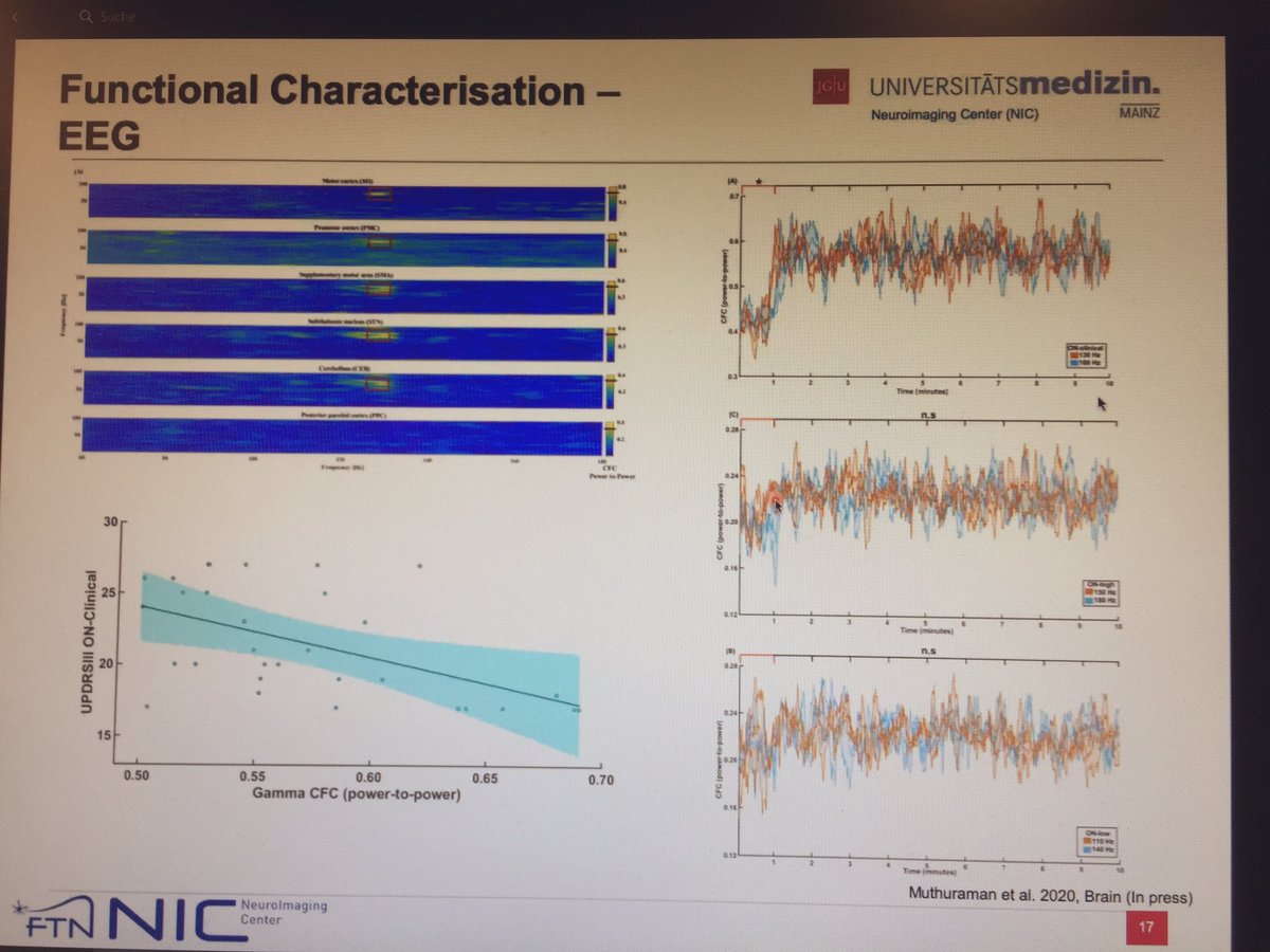 bahnebahners's tweet photo. Great talk by @muthu100680 at our institute‘s virtual seminar @HHU_de ! Really looking forward to read more about #crossfrequencycoupling at different #DBS frequencies soon (in press @Brain1878) 🧠 https://t.co/WKHr2CcDRa