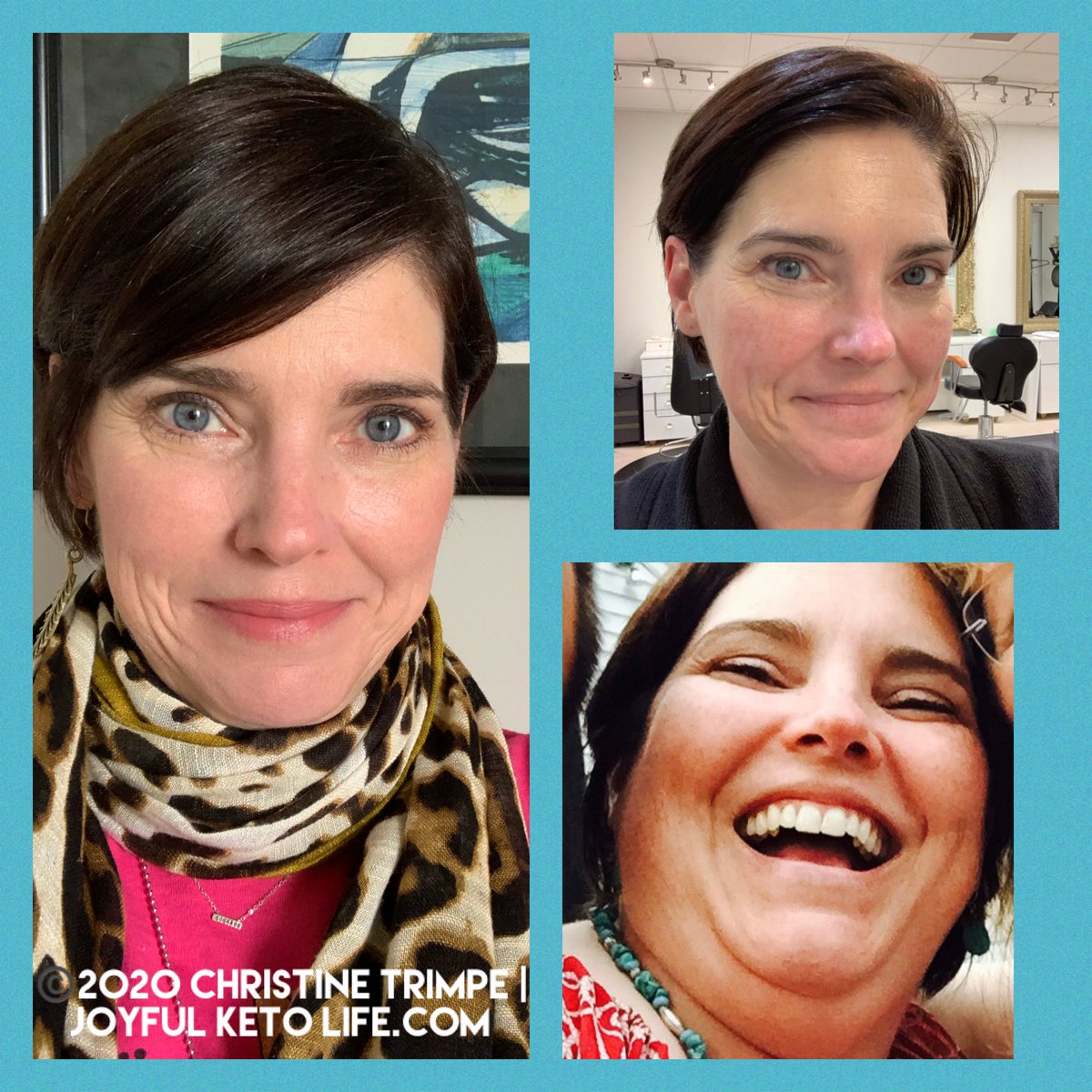 TrimpeChristine's tweet photo. When one of your friends is an RN Esthetician💕🤍 #TransformstionTuesday #KetoHeals #ketohealsskin Keto eliminated my cystic acne, for which I’m grateful. Those buggers hurt! https://t.co/i2YtmciU77