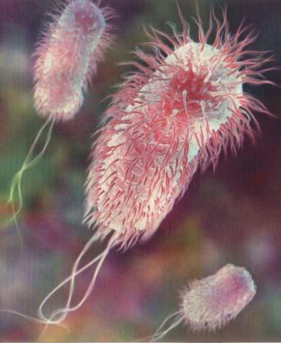CamsClub_IAU's tweet photo. اكثر بكتيريا مشهورة من هذه العائلة هي Escherichia coli وهي بكتيريا طبيعية (Normal flora) تعيش بالجهاز الهضمي ولكن زيادتها قد تكون مضرة جداً 😰
الاصابة تحدث عند اكل طعام ملوث او شرب ماء ملوث وقد تأتي ايضاً من قلة النظافة عند بعض الاشخاص 🥴
#CLS219
#CLS220 https://t.co/qJtOPwDu86