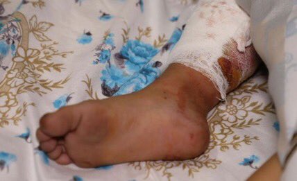 nigar_baghish's tweet photo. I don't want to hear about #children's deaths anymore. I don’t want to hear the death news of #civilians from the #terror committed by #Armenia. Souls taken by the #ArmenianTerrorists today 27.10.2020...💔 #BevoiceofBarda #PrayForBarda Just Stop #KillingCivilians https://t.co/AhMeGoGRoP
