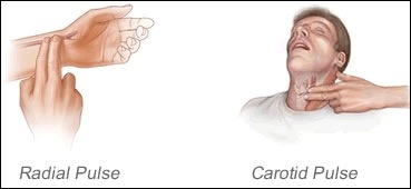 IF UNCONSCIOUS:-Get to hospital ASAP (911 or, preferably, put them in a car and drive real fast)-In meantime, check for breathing and a pulse-If no pulse, start CPR or get someone who knows CPR~~~More to come, stay tuned!