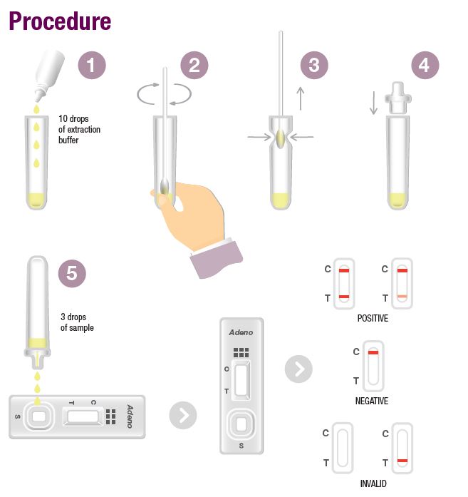 MicrogenBioProd's tweet photo. PathFlow® Adenovirus
* Differential detection of adenovirus from other diseases
* Positive results may be visible from as little as 3 minutes
* Can be used with multiple sample types
#NCYT #PathFlow #MicrogenBioproducts https://t.co/vSE4RjUsCE