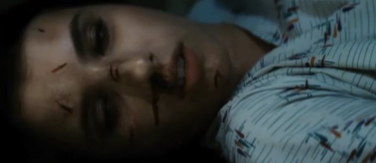 When Jill dies, she falls face-down. However, the last shot of her face shows her body supine and face-up in the alternate ending.