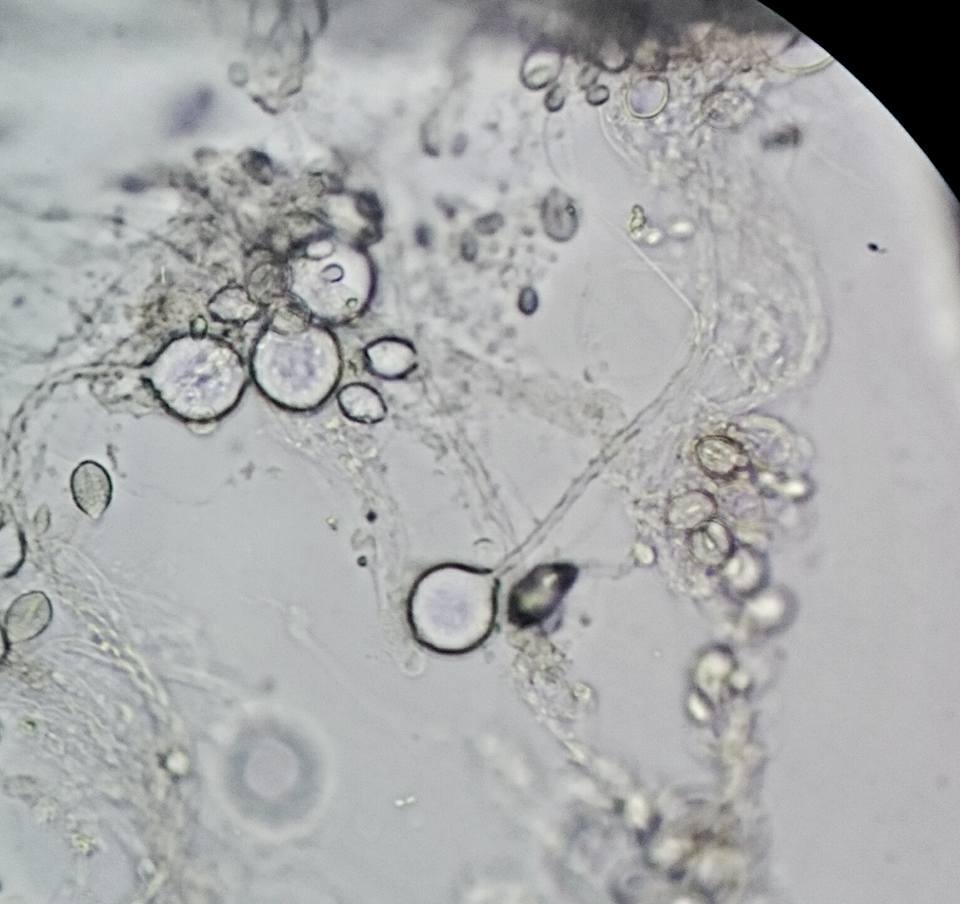 CPRSurvey's tweet photo. Nematocysts are the stinging cells of jellyfish. When stimulated, they burst open with barbs acting like a drill, penetrating into the foreign object. If present, toxins pass through the hollow thread, penetrating &amp; paralysing the victim’s tissues! #Worldjellyfishday #1daylate https://t.co/1f5H6bCZoz