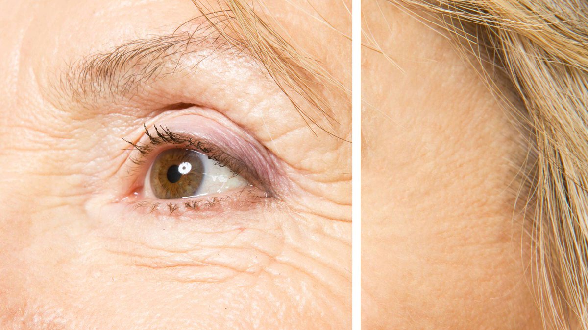reticshop's tweet photo. How to get Tretinoin cream without prescription

At https://t.co/8OEokE218i easy tp get it

#isotretinoin #tretinoin #isotretinoina #serum #skincarejunkie #facecare #skinroutine #summerskincare #iloveskincare #naturalbeautyblogger #facecareproducts #aussiebeauty https://t.co/sbk1Ij84C3