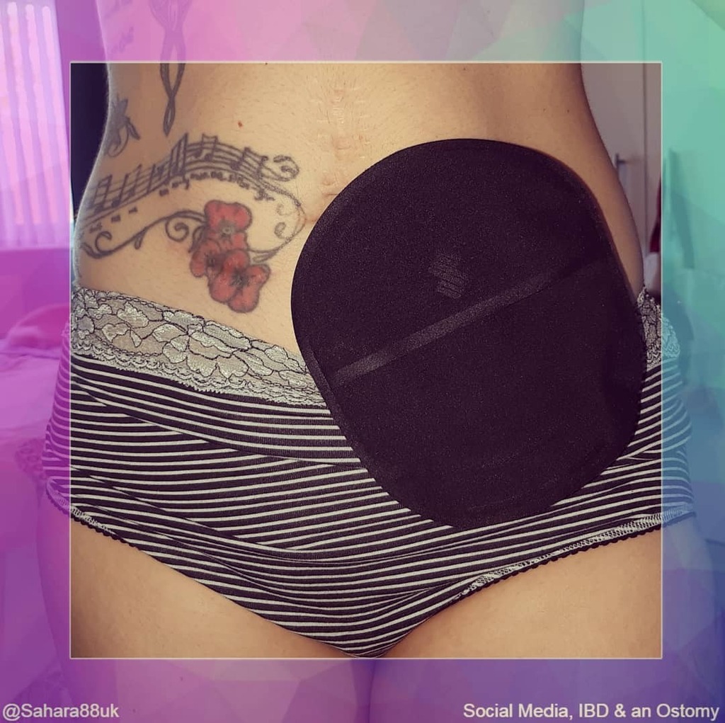 Sahara Fleetwood-Beresford 🌱 Patient Advocate 🩺 tweet media