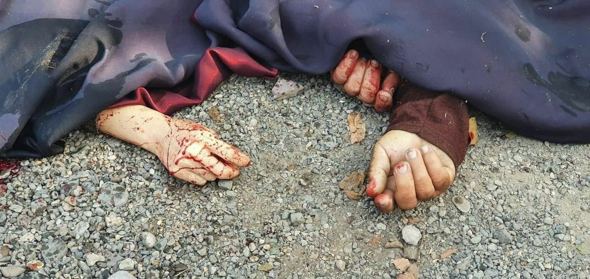 narageray's tweet photo. How many killed and wounded civilians, damaged infrastructure, night shellings of heavily populated areas the world needs to take necessary actions to stop this crime against humanity?Are you blind? @UNICEF @CNNPolitics @CNN @BBCWorld @BBCNews #StopArmenianTerrorism #BardaCity https://t.co/ujt689ts7X