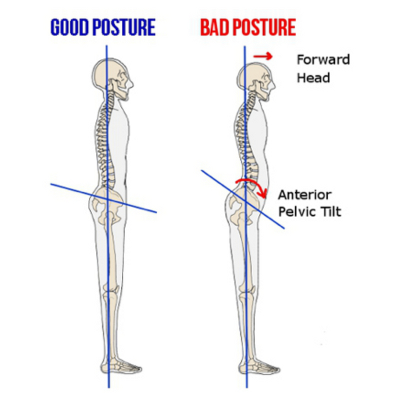 POSTURE CHECK:

To facilitate correct movement of the thoracic spine and shoulders in the golf swing we want a neutral spine.

This means that the centre of our hip joints, shoulder joints and ears should all be in a straight line.