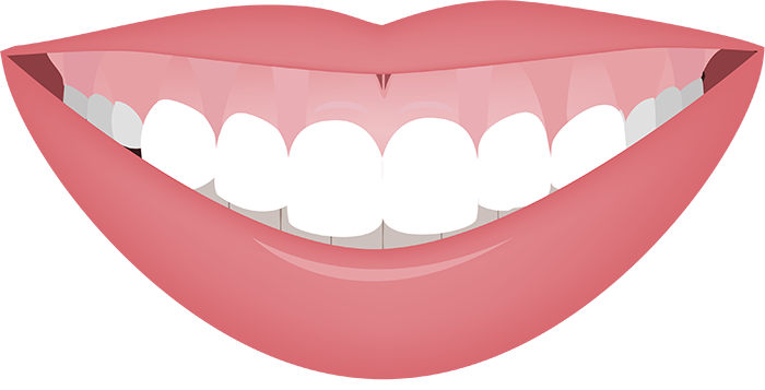 LaPeriodontics's tweet photo. Gummy Smile - Before and After https://t.co/tJNZ8hfnX7 #gummysmile #periodontist #drranashahi #smile https://t.co/bJO34VAZSg