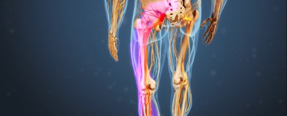 Spinal_Stenosis's tweet photo. What is acute sciatica? We have the answer here: https://t.co/PXYlNo0oHz
Sciatic Nerve Pain #usaspinecare #getyourlifeback https://t.co/9iQHtcNmYc