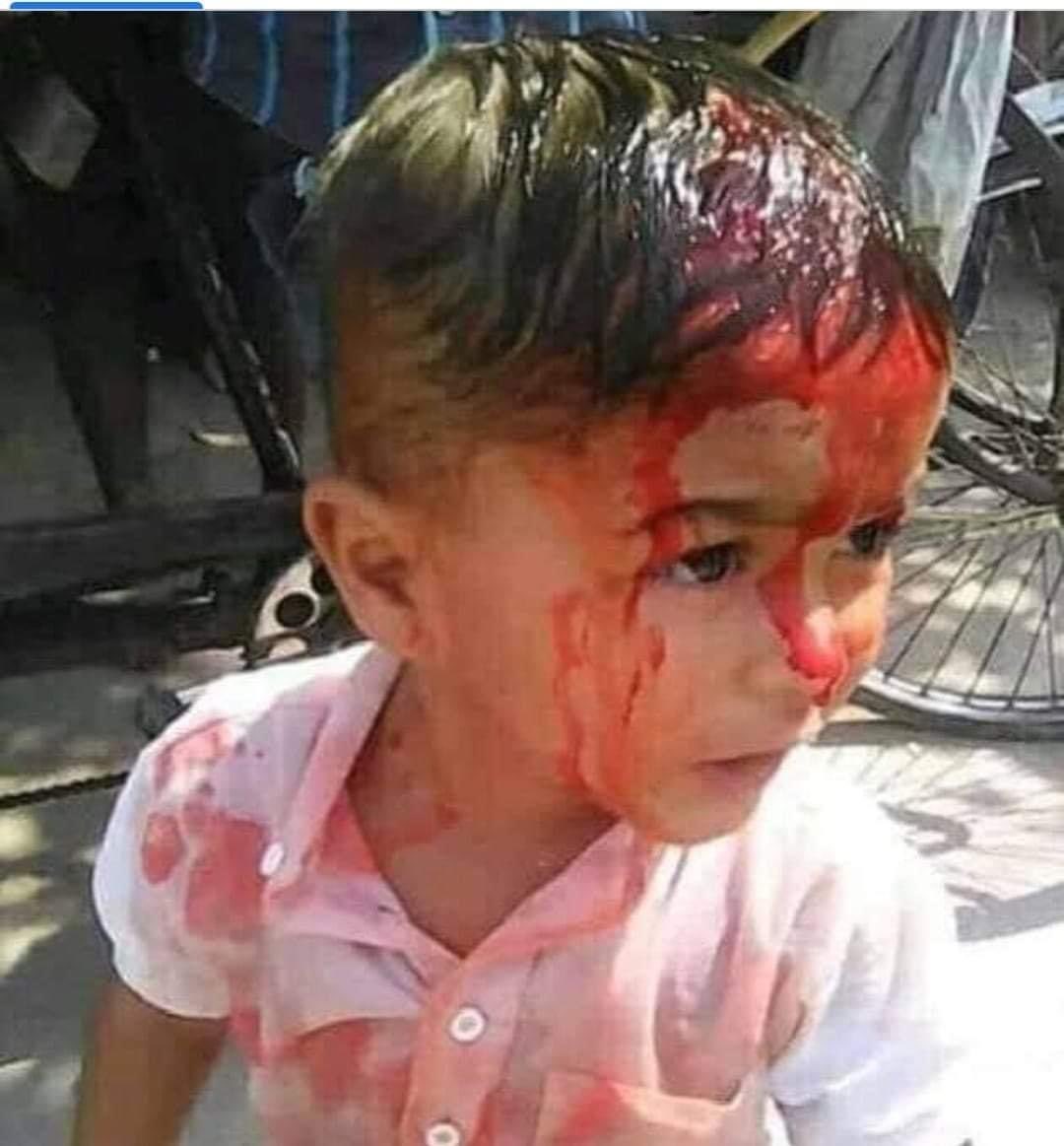 EminMammadov_'s tweet photo. #PrayForBarda #prayforbarda https://t.co/0lHnpuGBnQ