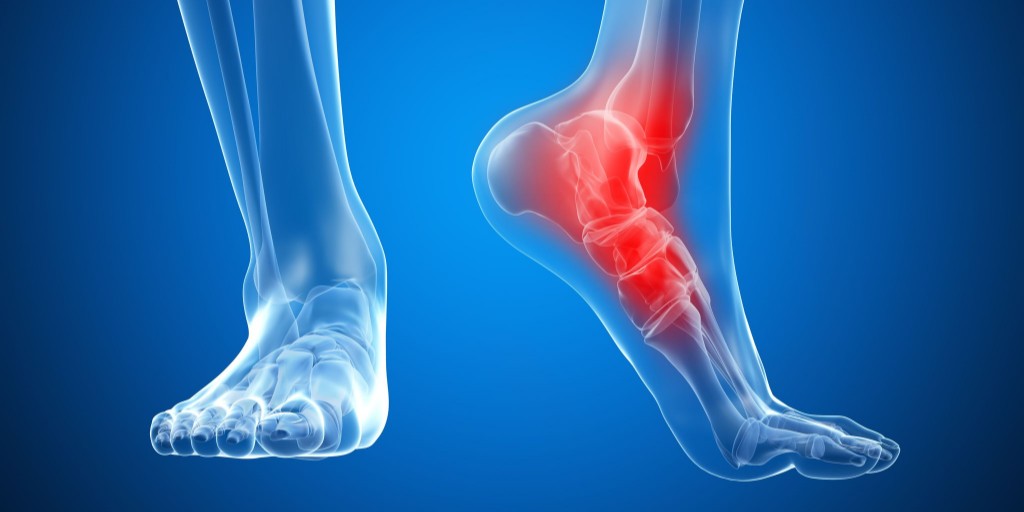 Do you suffer with: Plantar Fasciitis • Foot Pain • Knee Pain • Hip Pain • Back Pain • Shin Splints • Pronation • Calloses • Bunions 

Customised #orthotics correct specific foot imbalance to reduce stress &amp; strain on your body.  

#FootPain #BodyPain #HealthandWellbeing