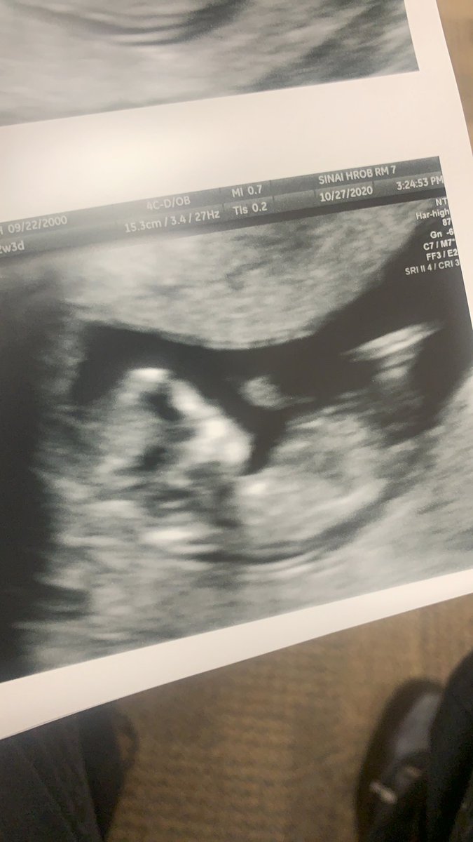 _ksimmons54_'s tweet photo. My baby 🥺💕💕💕 192 days left to go https://t.co/IgF0Tez633