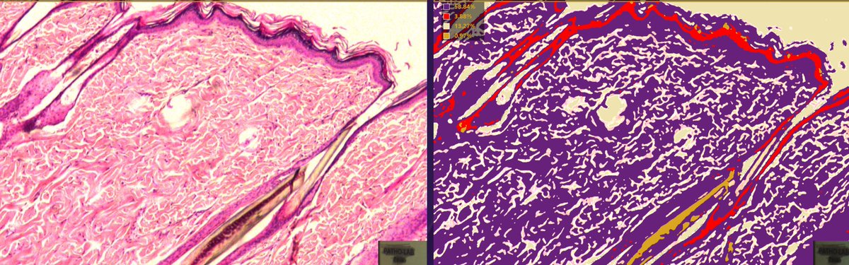 UMichPath's tweet photo. #PathVisions20: Some of the many applications that Augmented Reality Microscopy (ARM) benefits #pathology: real-time annot, and real-time image ansys. #Augmentiqs #UmichPath #AI
Read More:
β‘οΈ https://t.co/3pILjSIryz / Gabe Siegel
β‘οΈ https://t.co/LehmeigunL / @PathPro https://t.co/XCBXmS3100