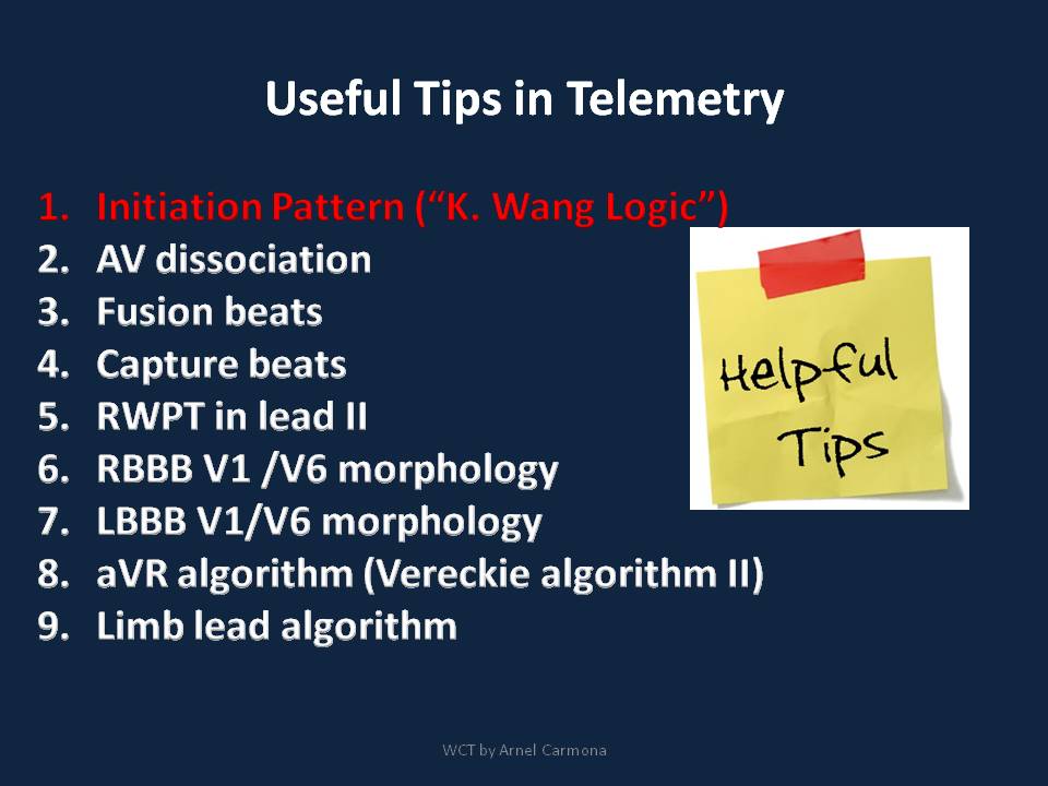 Pragmatic slide  #tweetorial on Wide Complex Tachycardia (WCT) with emphasis on Cardiac Telemetry. Part 2 - The initiation Pattern #FOAMed  #Meded  #Epeeps  #CardioTwitter  #MedStudentsTwitter