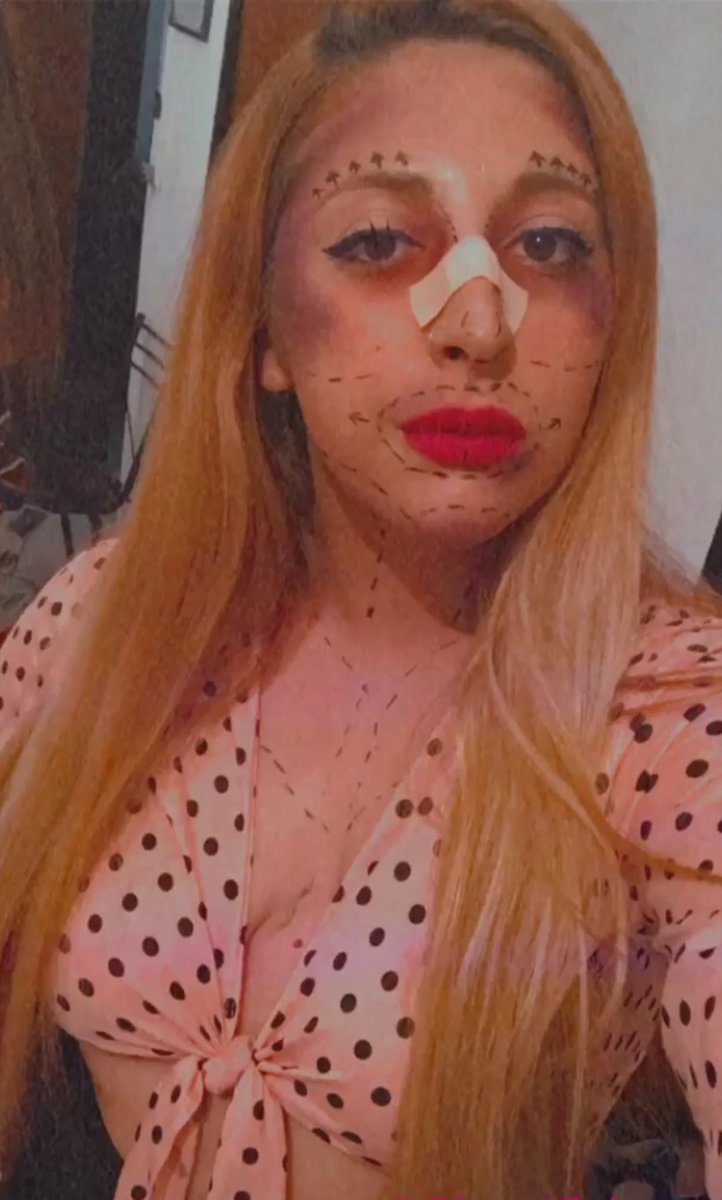 LovelyLucozade's tweet image. Hi Liam ! This is my interpretation of the exaggeration of the stereotype of beauty in society and the "perfection" that women seek with cosmetic surgeries, I hope you like it! happy Halloween 💕
@LiamPayne 💀
#LPCostumeComp #LPMakeUpComp #TheLPShow