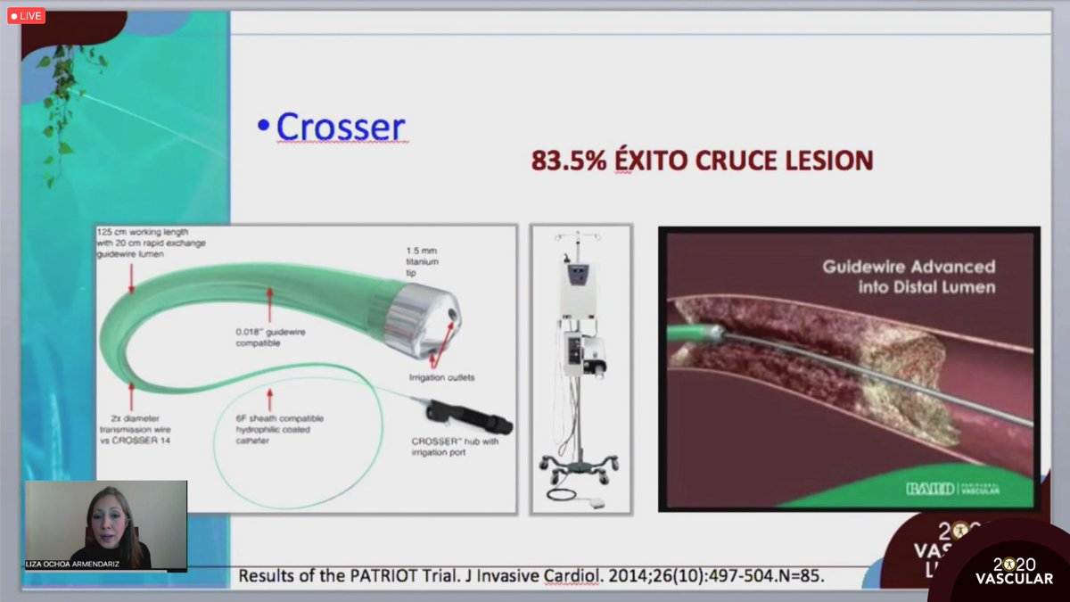 smacve_oficial's tweet photo. 📍LII Congreso Internacional de Angiología, Cirugía Vascular y Endovascular #Merida2020
SESIÓN AMEXIPIED "Pie diabético e Isquemia: la combinación del Desastre"
“Estado actual de la cirugía endovascular en el manejo del pie diabético isquemícol”
Dra. Liza Ochoa Armendariz https://t.co/NoqeVwCWjh