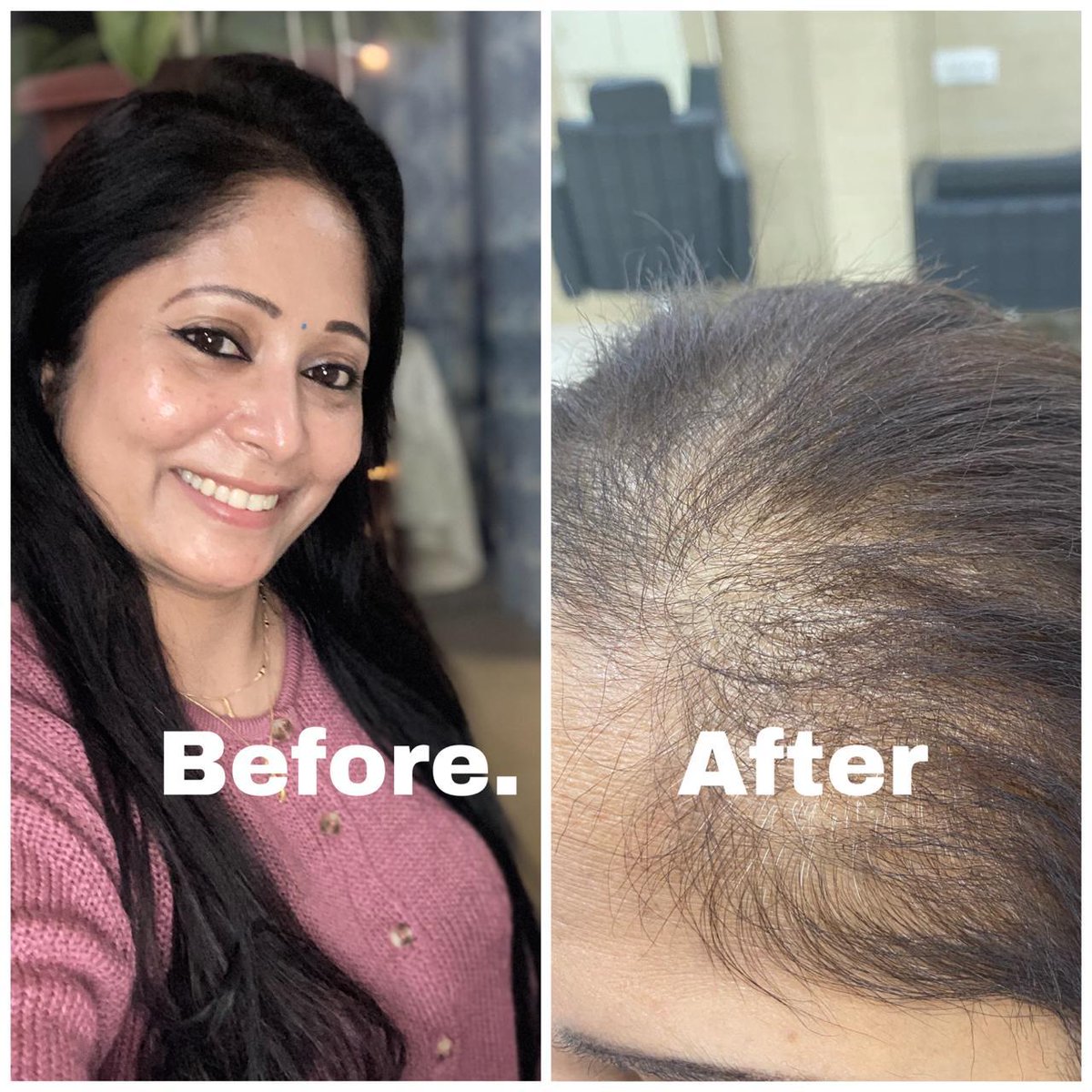 ahampurvasmi's tweet photo. Hi @Loreal @LOrealParisIn @MatrixHairIndia @LorealProfIndia Look what your 'original' products used in your 'original' Matrix Salon by 'experts' have done to my friend's beautiful mother... She went for smoothening and in return, they burnt her hair!! #MatrixIndia https://t.co/uD7G5Ob2kr