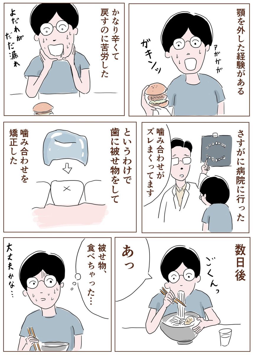 治ってるわけじゃないから大きな口を開けるのいまだに怖い… 