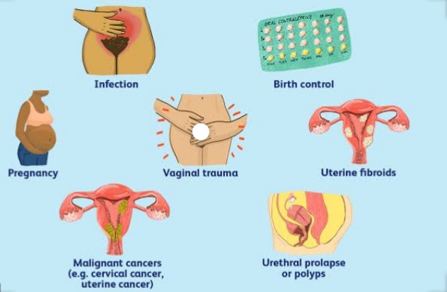 ZeeB12195291's tweet photo. Women go through all these  things..aren't they enough?!

#EndTp infection
#womenlivesmatter https://t.co/pjFI0Wr9mQ