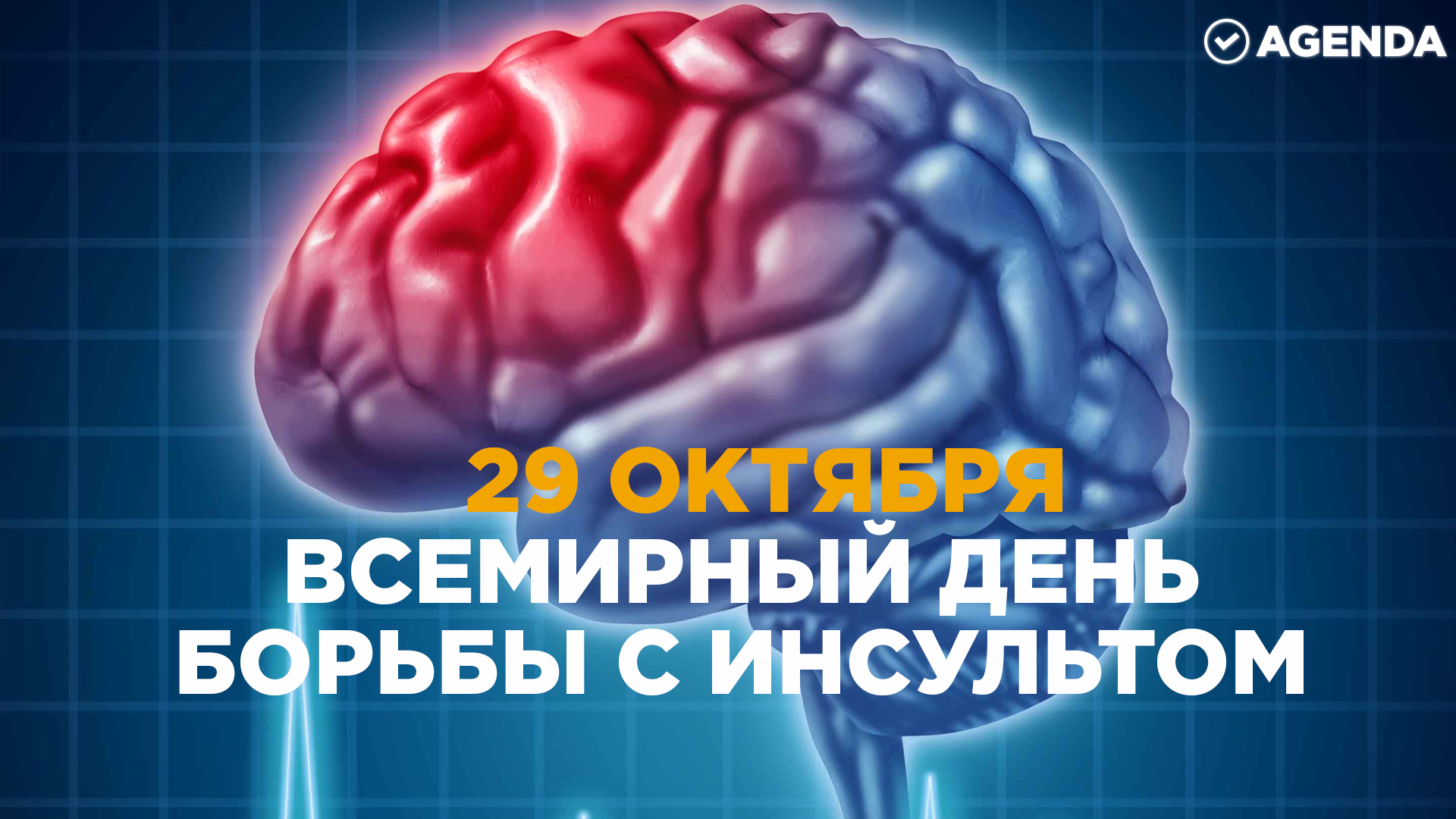 День инсульта