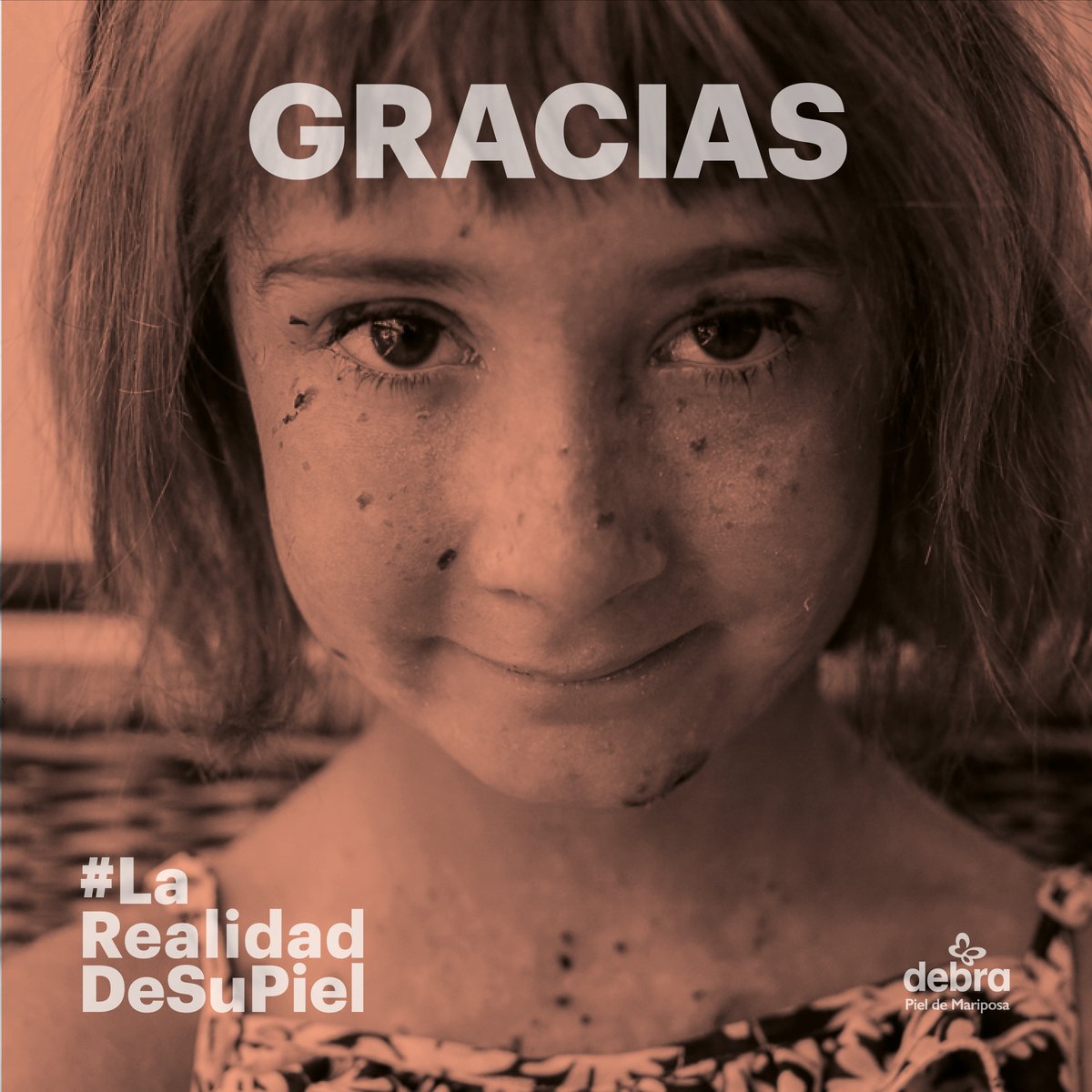 pieldemariposa's tweet photo. Gracias por no mirar a otro lado y descubrir #LaRealidadDeSuPiel. Gracias por darnos voz, por enviarnos mensajes de apoyo, por donar, por hacerte socio/a... A todas y cada una de las personas que de una u otra forma nos habéis apoyado 🙏 Nos dais fuerzas para seguir luchando 🦋❤️ https://t.co/AZD2csTDdX