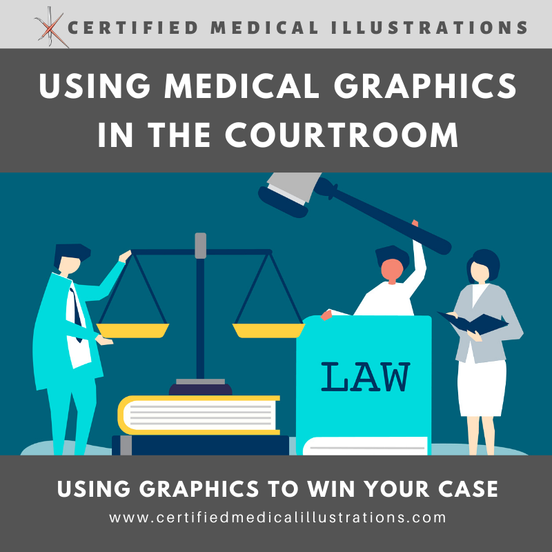 CMIexhibits's tweet photo. For the #personalinjury #attorney who wants to increase the recovery for his client, #trialgraphics be used to help the jury understand the #injuries. #CertifiedMedicalIllustrations https://t.co/SQNW7c5SFy https://t.co/R8nz0y2ynb