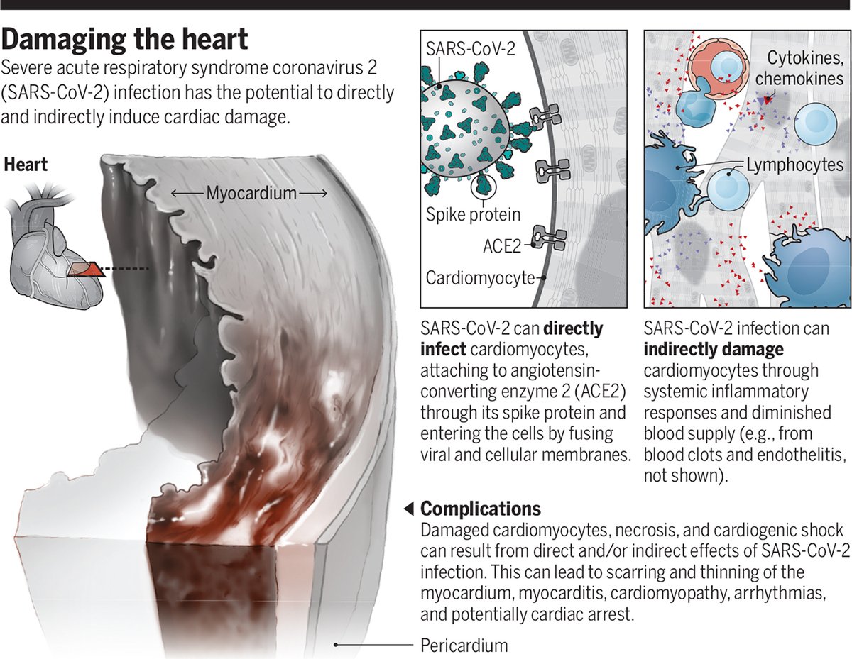 ScienceMagazine's tweet image. A new #SciMagPerspective reviews data on the growing and diverse impact of #SARSCoV2 on the hearts of patients and highlights a “fundamental and large hole” in researchers’ knowledge base regarding what drives this pathogenesis.

Read more: fcld.ly/zm83wnz