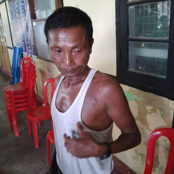 Artillery shells hit the villages andbfive civilians were wounded in Kyawshin village of PauktawvTownship, Arakan  (29 Oct 2020)
facebook.com/10240510489933…