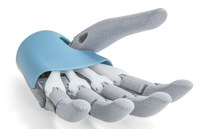 Oceanz3Dprint's tweet photo. Deze mHand Adapt; is de lichtste cosmetische hand die verkrijgbaar is. Metalen onderdelen zijn vervangen door 3D geprint kunststof en dat levert deze voordelen op: 
https://t.co/hMGlrMvFsP 
#3Dprinting #prothese https://t.co/89Eq5QIlnJ