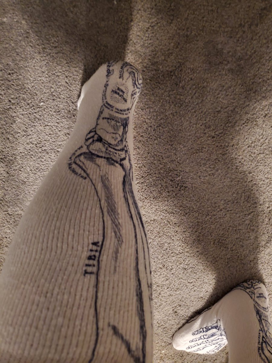 MrsBakerWMS's tweet photo. When one of your students is having surgery to fix a break and its Halloween week....you bust out your bone socks a day early! 🦴 #Scienceisfun #Nothumerus https://t.co/zDUxSD2eLQ