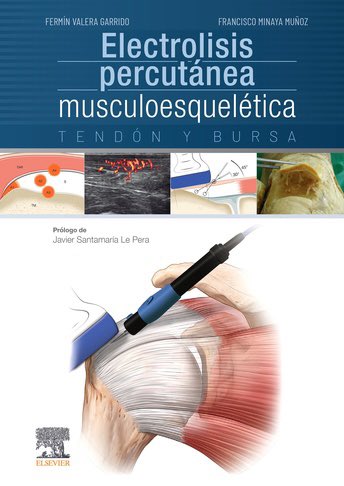 Anunciamos el lanzamiento del NUEVO LIBRO “ELECTROLISIS PERCUTÁNEA MUSCULOESQUELÉTICA. Tendón y bursa, 1ª Ed.” <a href="/Elsevier_Es/">Elsevier Español</a> 
una referencia para todo profesional formado o que tenga un interés futuro en la técnica, para proporcionarle una 
guía con la que sistematizar su trabajo