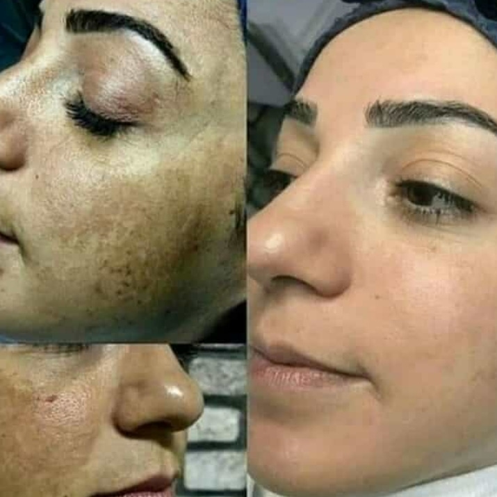 Sağlıklı bir cildin olsun ister misin? 
sagliklikazan.com
#saglıklıcilt #güzelolmak #işıltılı #ciltler #sağlıklıürün