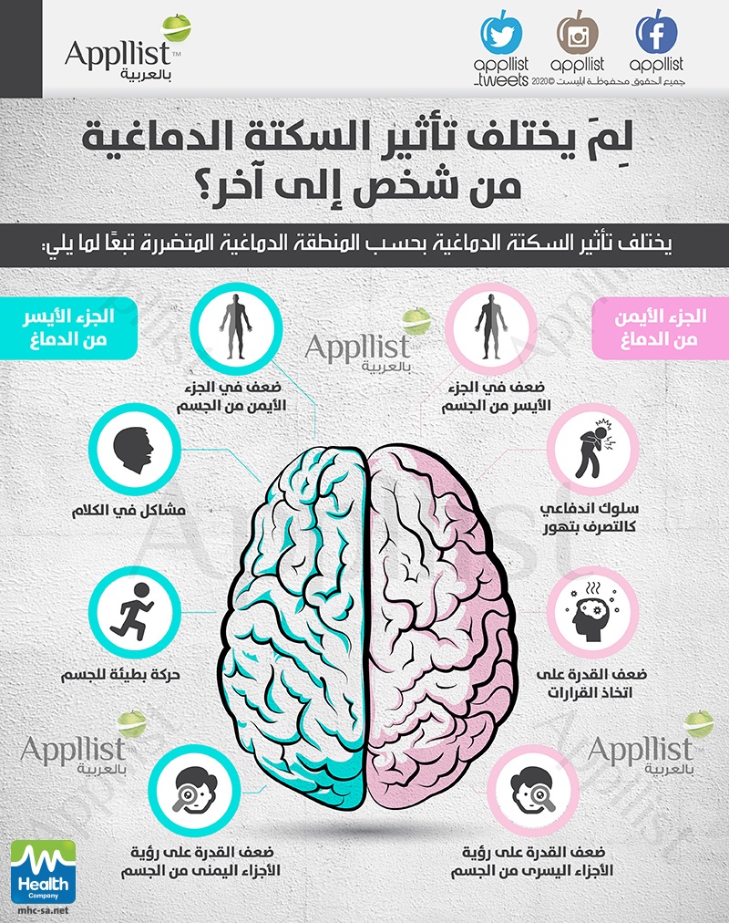 لٍٍمَ يخلتف تأثير السكتة الدماغية من شخص إلى آخر ؟ 
#اليوم_العالمي_للسكتة_الدماغية
#فيروس_كورونا 
#أبليست_بالعربية
#انفوجرافيك 
#صحة 
#worldstrokeday2020