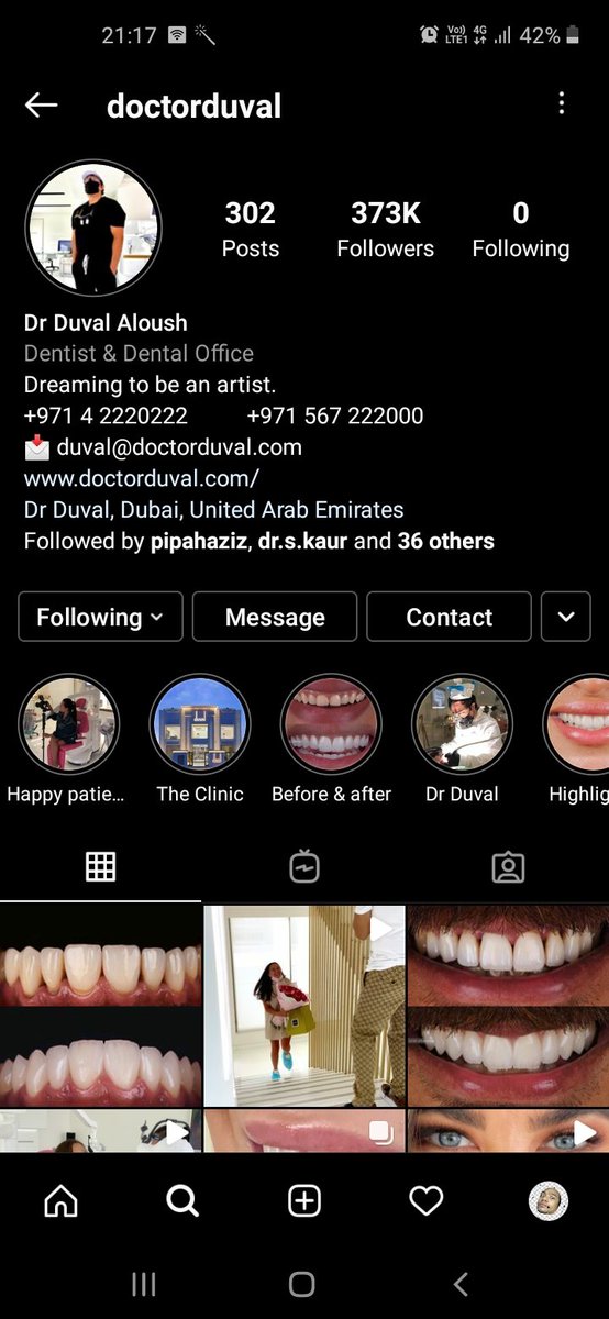 Btw kalau nak tengok smile transformation yang taraf celebrity hollywood, belek ig  @doctorduval.