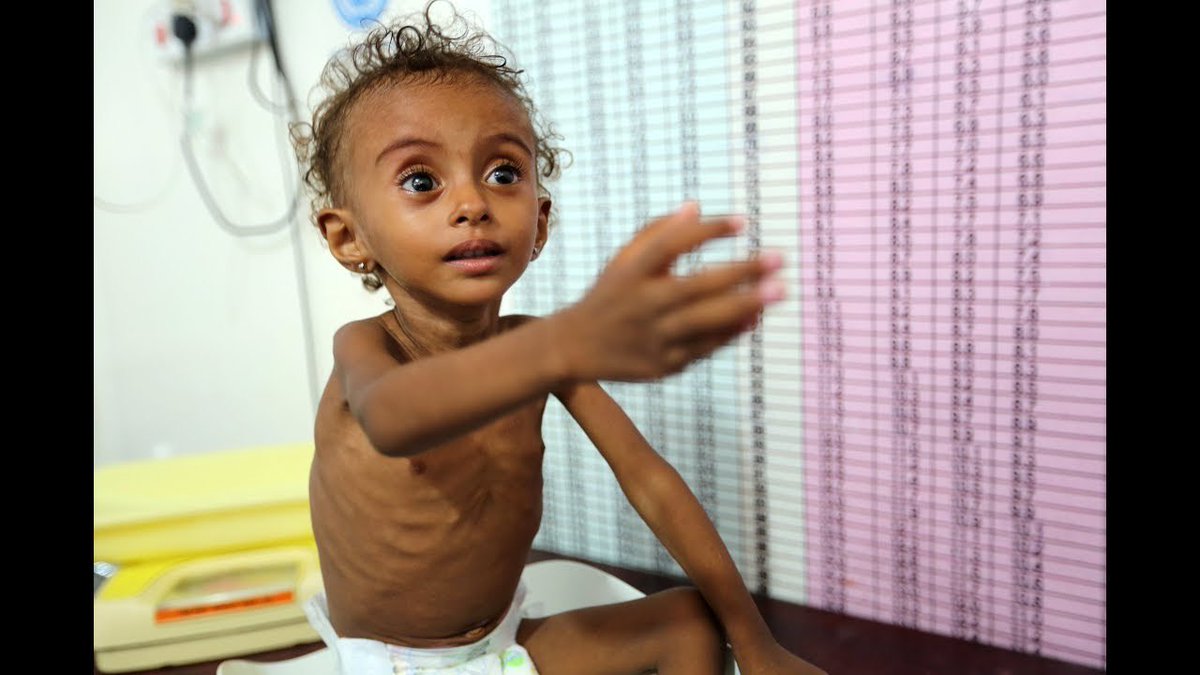@SecPompeo As a self-styled #Christian leader can you say a word about the 130,000 #Arab kids #Yemen that you personally help kill & starve to death? https://t.co/ox1UcL0tGG