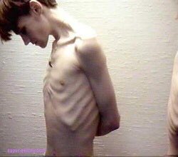 Skinny_bums's tweet photo. #thinspo #bonespo #proana #promia #edtwt https://t.co/ZFG2kd9QXZ