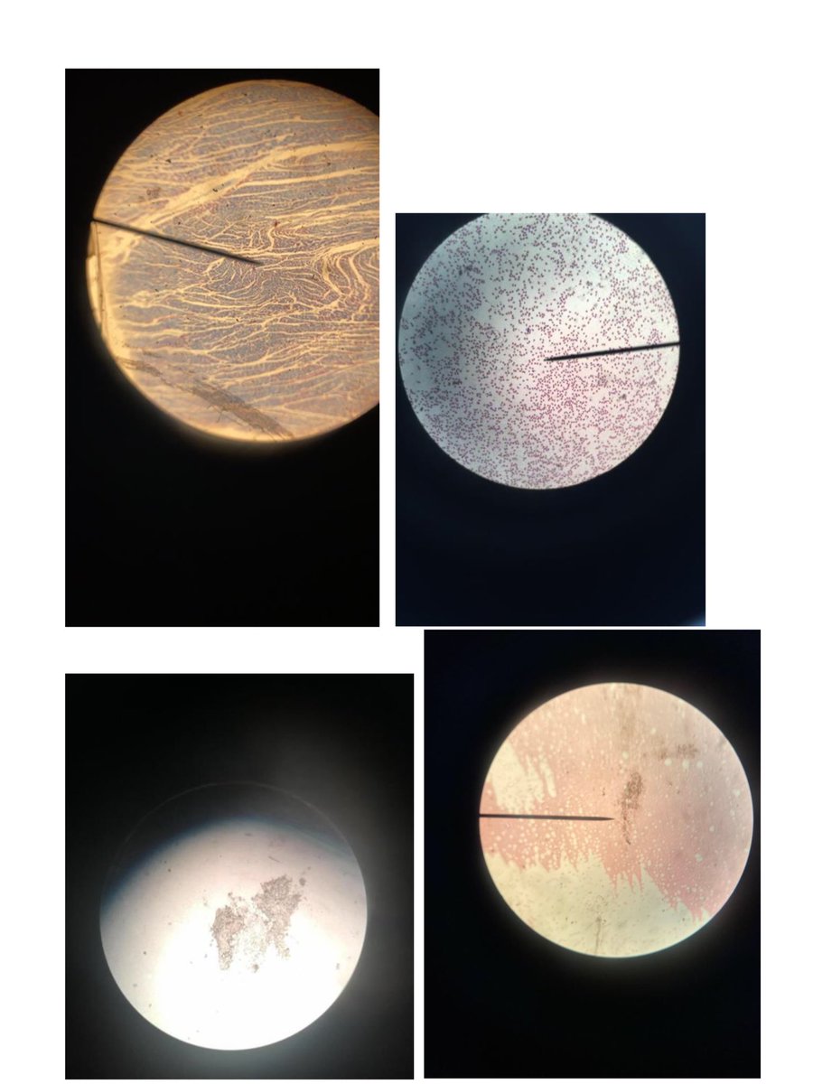 MintlawSci's tweet photo. After a long wait, Mrs Carr’s #N5Bio were very pleased to get their hands on a microscope and develop their microscopy skills! These images show how well they did - great work! #LearningTogether https://t.co/vgrKxHPxbL