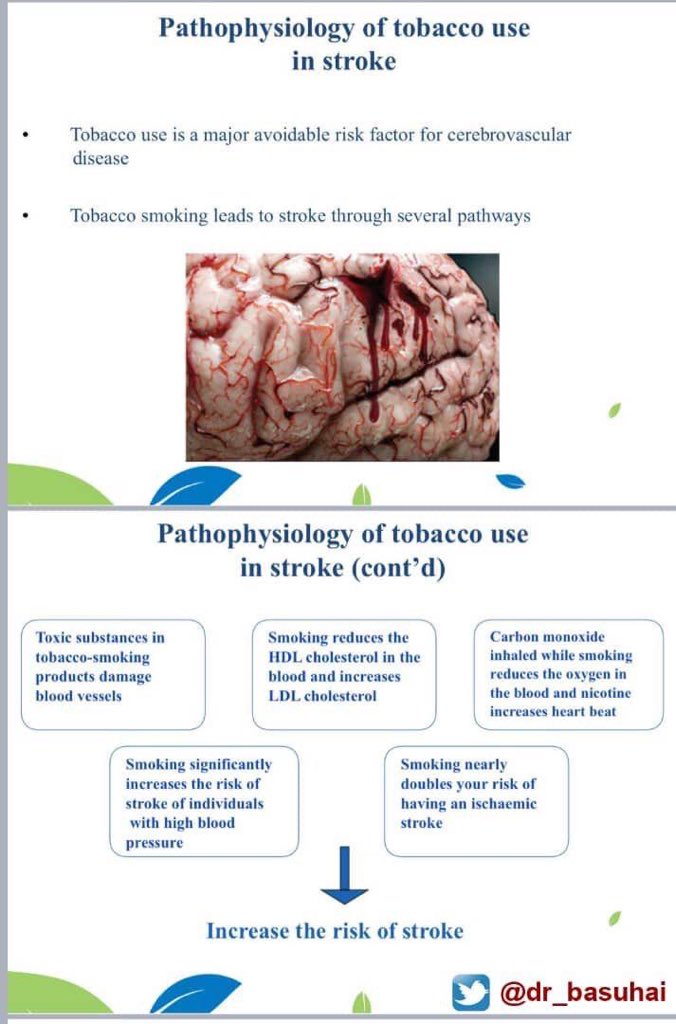 #اليوم_العالمي_للسكتة_الدماغية ٢٩ أكتوبر
#التدخين_سبب_للسكتة_الدماغية
#السكتة_الدماغية
#جلطة_الدماغ
#Stroke
#WorldStrokeDay 29 Oct.
#strokerecovery
#StrokeMonth