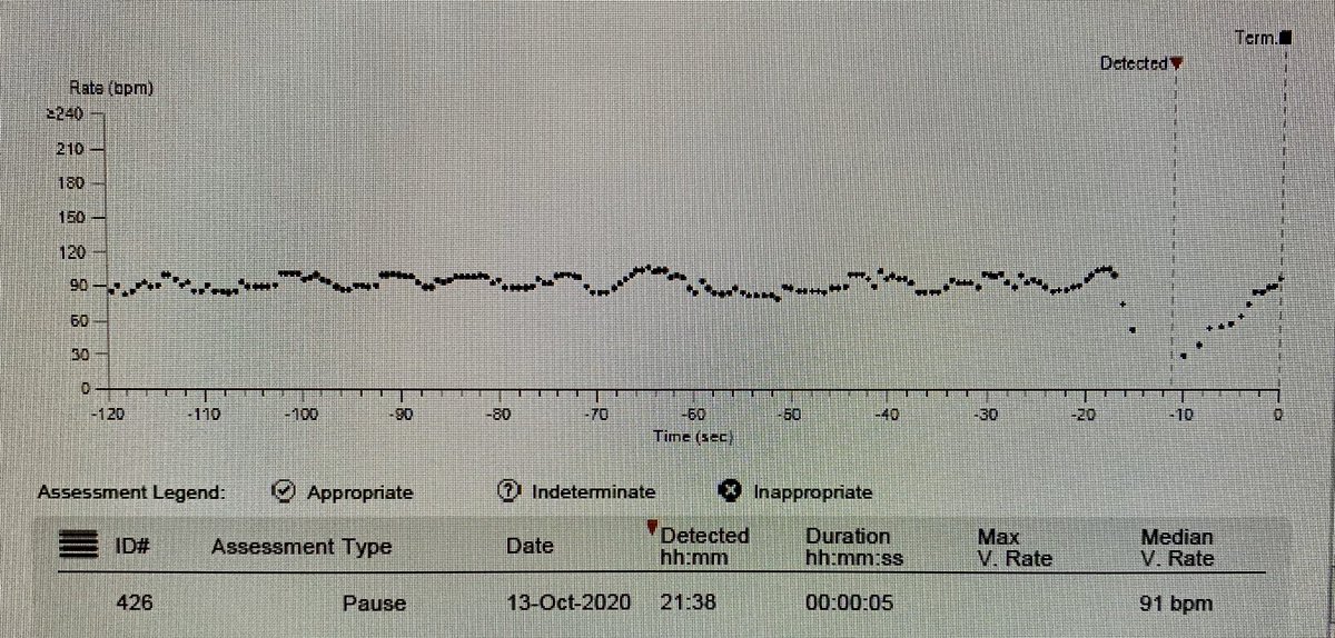 JRWinterfield's tweet image. How would you manage college aged  active woman referred to us @MUSCCardFellows with malignant vasovagal syncope with two serious episodes in two years and numerous pauses on ILR below?