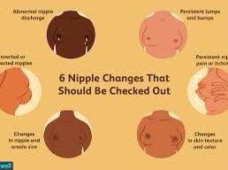 -nipple changes: when the nipple changes direction from normal or it becomes inverted (pulled in) or destroyed-nipple discharge: clear or bloody discharge is suspect-swelling in the armpit-change in size or shape of the breast-area of thickened tissue in the breast