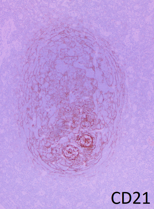 Triplets &gt; twinning