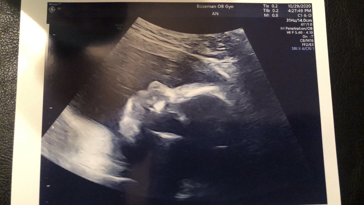 thecrowinator's tweet photo. 11 weeks to go🤰🏼🎀 https://t.co/2p4z4ooATD