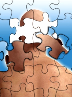 Alcoholic Dementia
Dementia is characterized by the loss of brain function, which ordinarily shows up as memory loss. Alcoholism and brain damage are linked due to the effect that heavy alcohol use has over the course of several years.  #alcoholismhelp
👉 bit.ly/2HQx1yx
