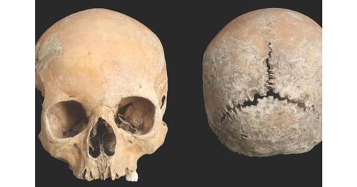 Pierre Vesperini : «Le crâne de cette jeune fille nous somme de comprendre les violences faites aux femmes» limportant.fr/infos-societe/… <a href="/philomag/">Philosophie magazine</a>