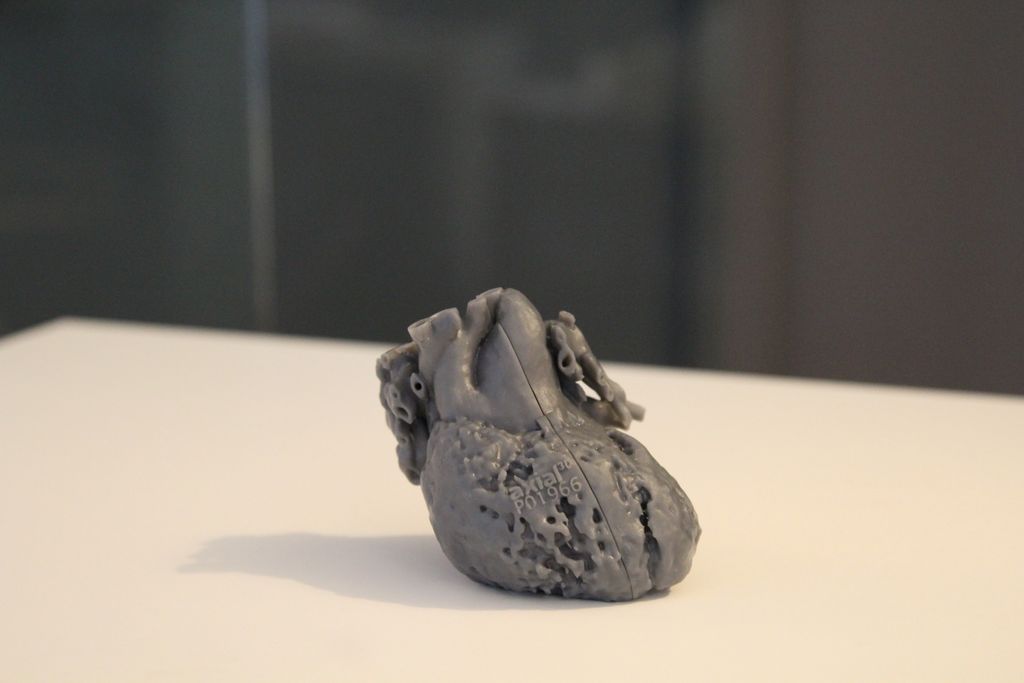 Axial_3D's tweet image. Read about how this 3D anatomical model allowed surgeons to carry out a cardiac surgery with zero complications and perfect surgical results for the patient. 

#anatomicalmodel #preopplanning #CTscans #patientcare #enablingsurgicalinnovation #cardiacsurgery #fistula #mitralvalve