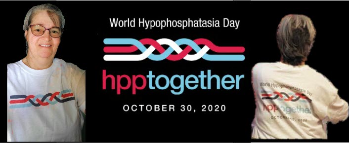 d3sert's tweet photo. Celebrating World Hypophosphatasia Day!

#HPPTogether, #SoftBones, #HPPAware, #WorldHPPDay,

#Hypophosphatasia https://t.co/Sj0krd9YS5